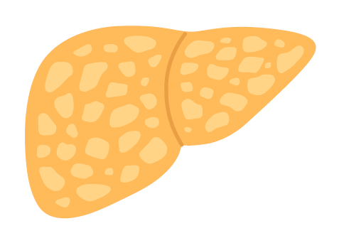 肝臓（脂肪肝の状態）
