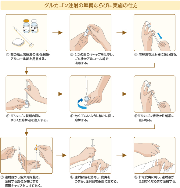 筋肉 注射 手技