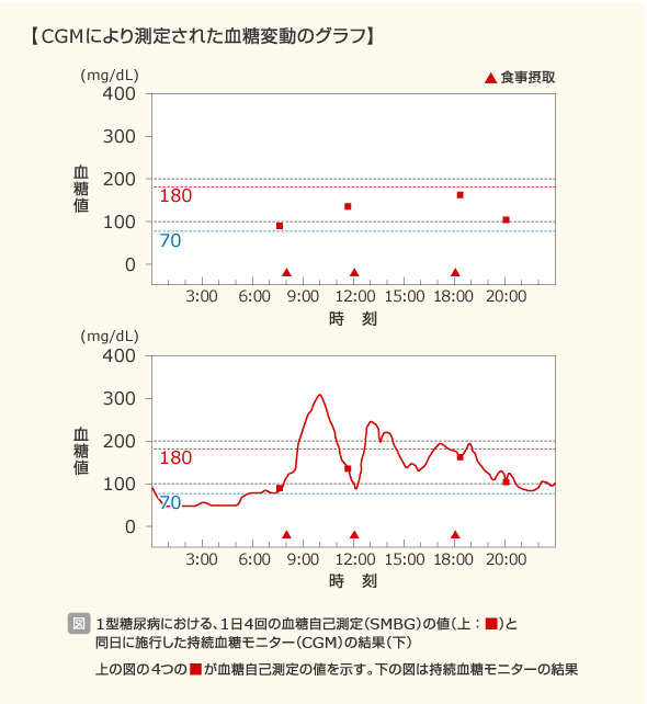 自分は低血糖になっている 自分は低血糖になっている