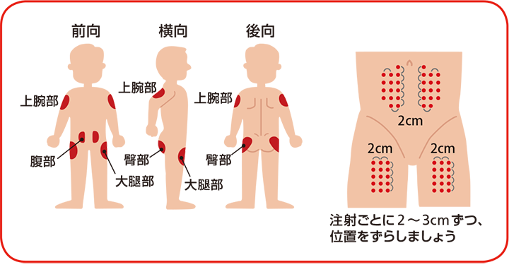 正しい注射方法